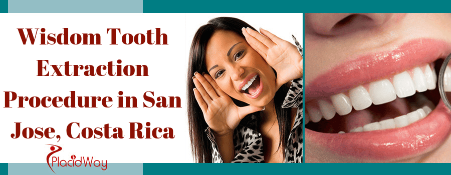  Wisdom Tooth Extraction in San Jose, Costa Rica